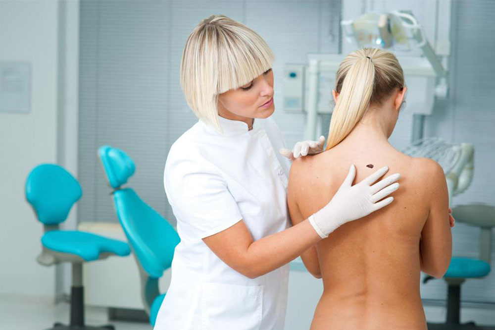 Melanoma &#8211; Early Signs of the Skin Cancer